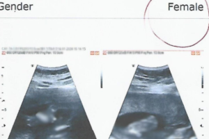 Justiça condena médico e clínica a indenizar mulher após erro na identificação do sexo do bebê